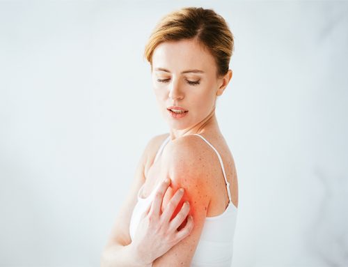 How to Treat Frozen Shoulder
